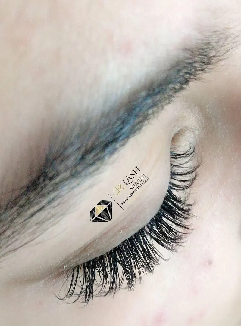 ترمیم و کاشت مژه