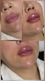 کلینیک پوست،مو،زیبایی و لیزر دالیا