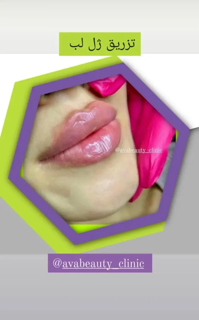 managed-by-sync_ad_images:imp-e23f55a4a3cb162f7ab0