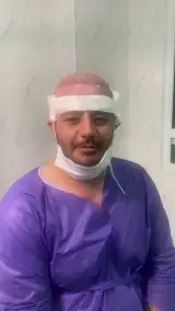 کلینیک کاشت مو و ابرو آزاد رستمی