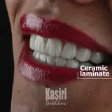 دندانپزشکی دیجیتال دکتر مهدی کثیری