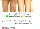 مرکز تغذیه و رژیم درمانی و لاغری
