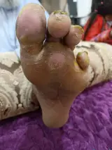 منصورشکوری، دکتر طب سننتی و درمانگر زخم