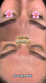 خدمات فیشیال و آموزش تخصصی پوست فروغ