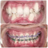 دندانپزشکی کودکان دکتر شقایق جمالی