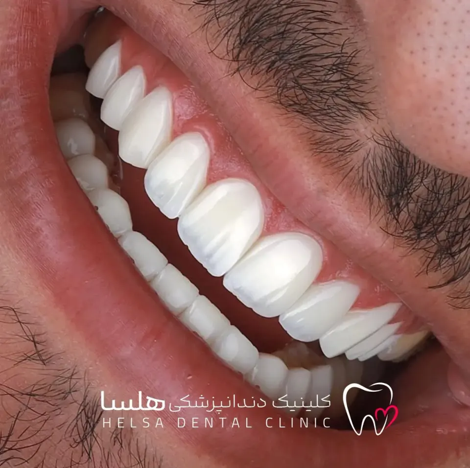 کلینیک دندانپزشکی هلسا(اقساط)