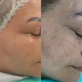 کلینیک پاکسازی پوست نرگس اندواری