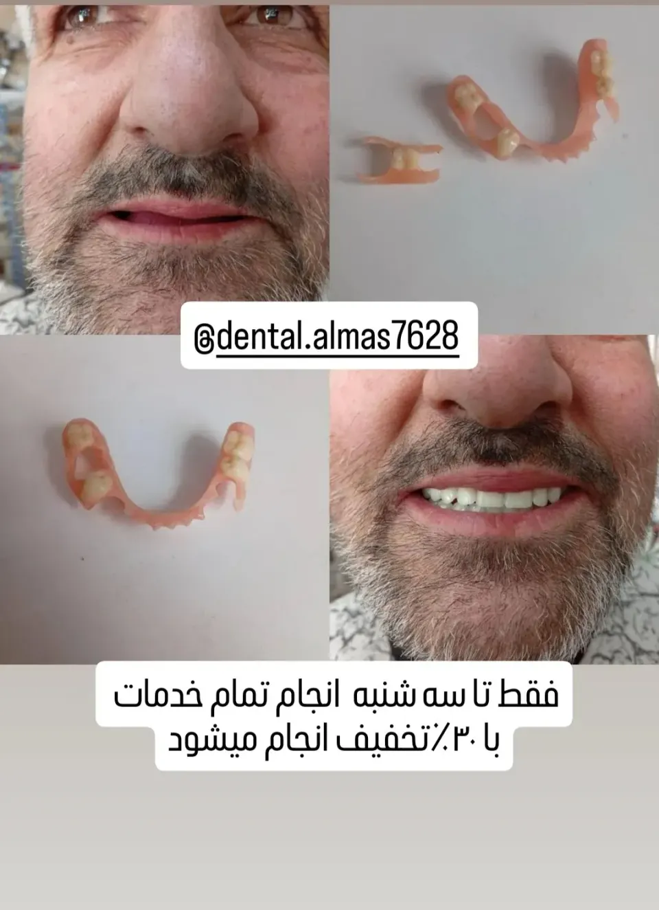 کامپوزیت لایرینگ و دندانسازی دکتر صفری