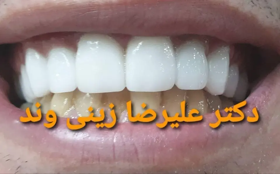 دندانپزشکی دکتر زینی وند