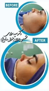 کلینیک جراحی زیبایی پروانه