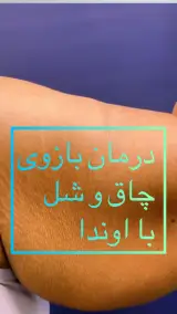 مرکز لاغری مدرن