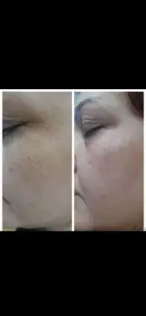محمدی کراتین