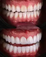 دندانپزشکی دکتر هومن باقری (بیمه نداریم)