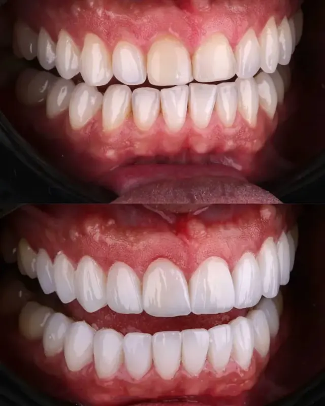 دندانپزشکی دکتر هومن باقری (بیمه نداریم)