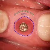 دندانپزشکی دکتر مهدی کریمی در سعادت آباد