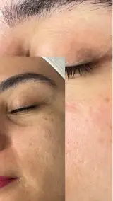 خدمات تخصصی پوست لیلیوم
