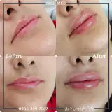 کلینیک پوست مو زیبایی و لیزر نیل