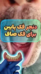 لابراتوار دندانسازی کیهان پروتز متحرک