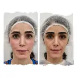 کلینیک تخصصی پوست مو زیبایی و لیزر هانا