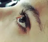 کاشت مژه