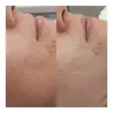 فیشیال تخصصی پیراپزشک فاطمه جلالی