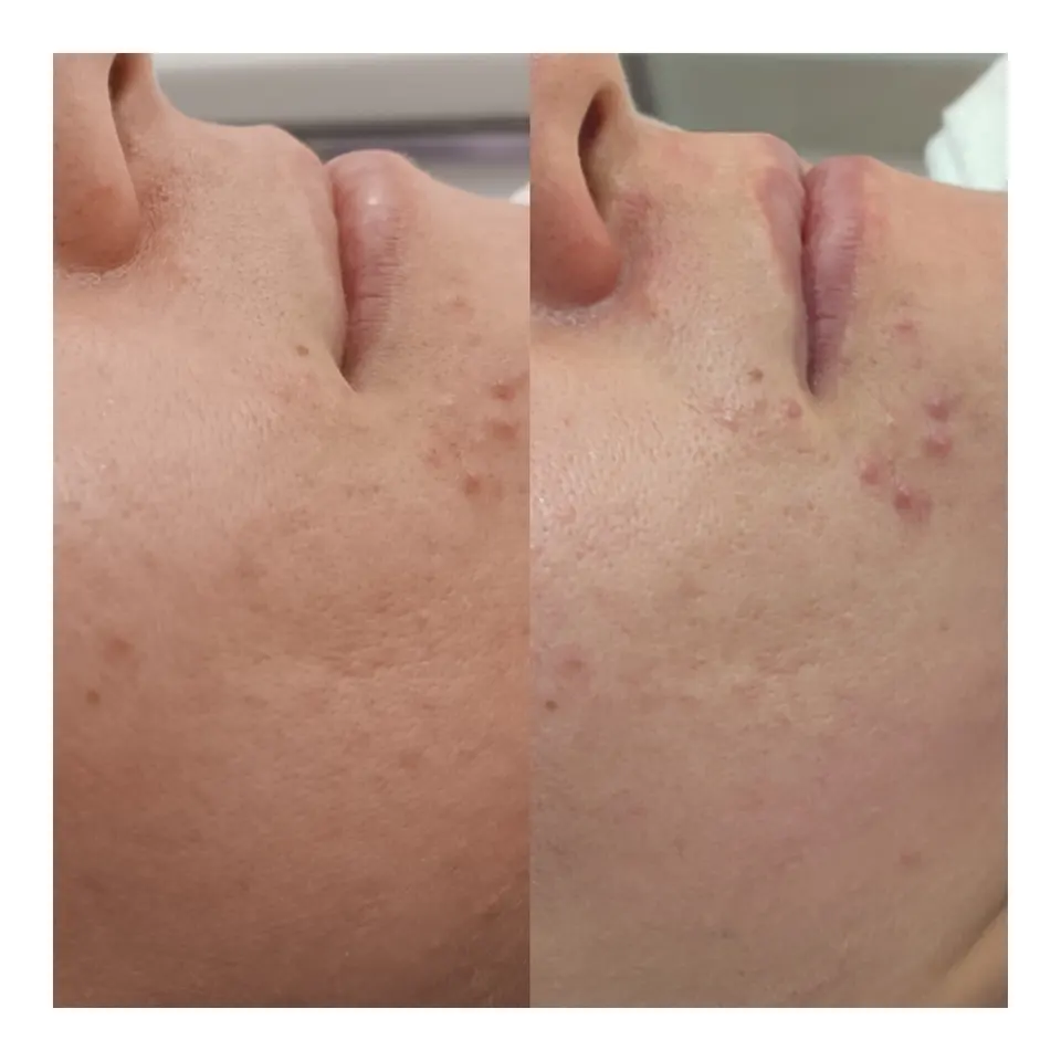فیشیال تخصصی پیراپزشک فاطمه جلالی
