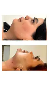 کلینیک زیبایی و مرکز لیزر روی ماه