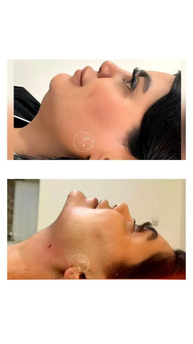 کلینیک زیبایی و مرکز لیزر روی ماه