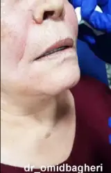 دکتر محمدحسین باقری کاشانی