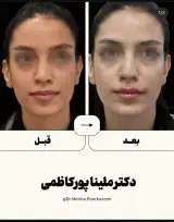 مطب دکتر ملینا پورکاظمی