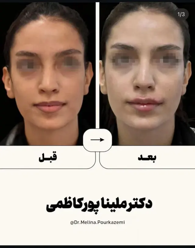 مطب دکتر ملینا پورکاظمی