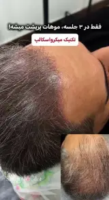 مرکز میکرواسکالپ عطار