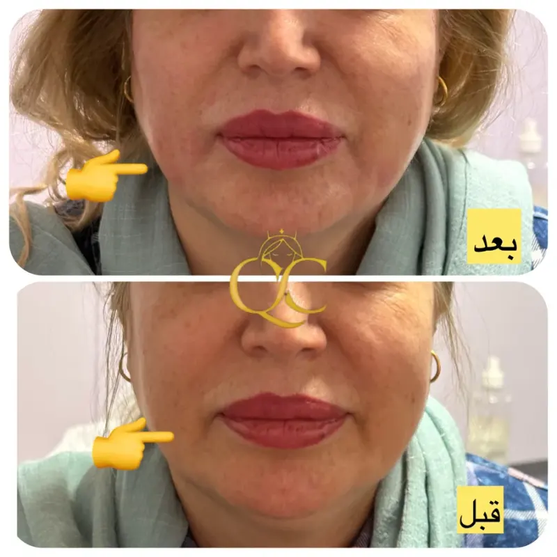 کلینیک زیبایی غزال