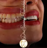 کلینیک دندانپزشکی زیبایی دکتر فرخ