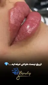 مرکز لیزر کلینیک زیبایی رزنیلای مرزداران