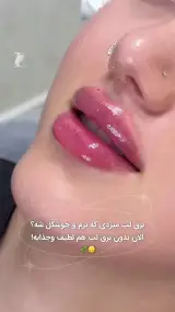 کلینیک لیزر و زیبایی آیریس