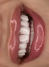 دندانپزشکی زیبایی جذاب