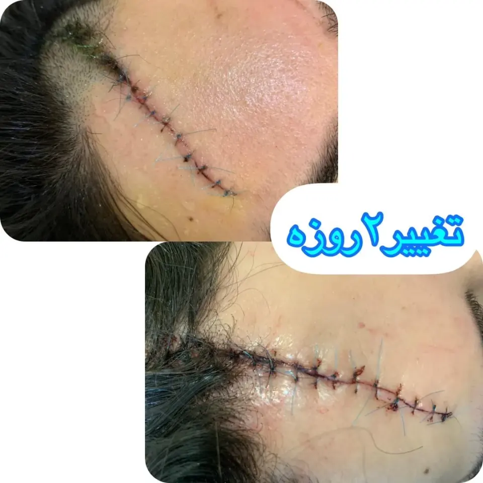 خدمات پرستاری نیک توان