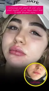 مرکز لیزر و کلینیک زیبایی پریفا