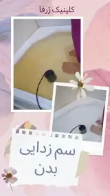 کلینیک طب سنتی و مرکز حجامت ژرفا