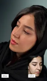 کلینیک جراحی بینی مینی bini mini
