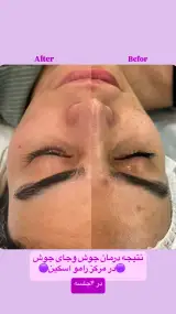 مرکز فیشیال تخصصی رامو اسکین