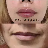 کلینیک زیبایی پوست و لیزر ایده آل