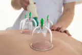 مرکز حجامت کیمیا
