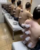 حجامت گلبرگ (فصد)دکتر رضایی فر