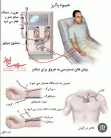 دیالیز دارالشفا سیدالشهداء (ع)