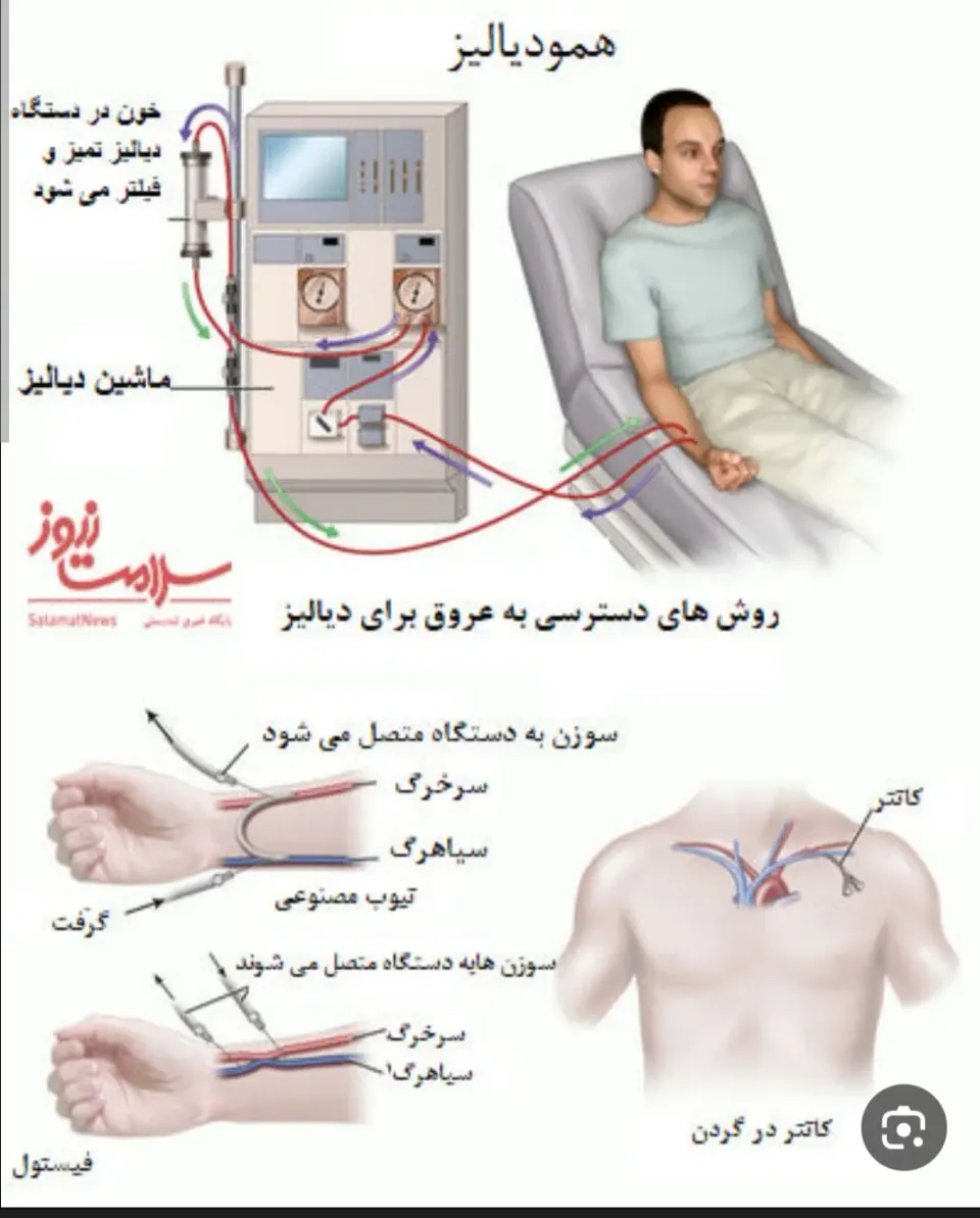 دیالیز دارالشفا سیدالشهداء (ع)