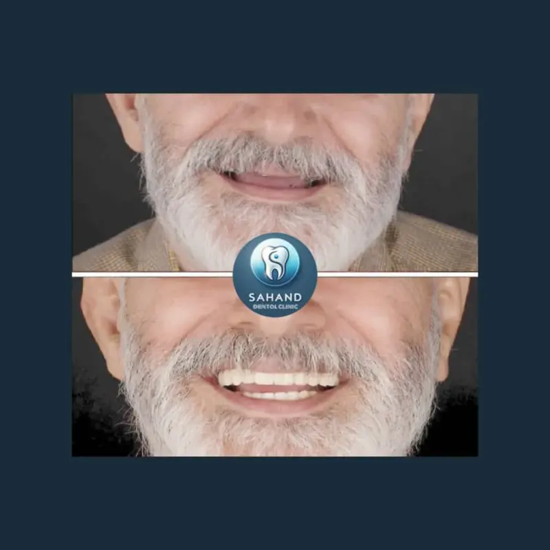 کلینیک دندانپزشکی وایمپلنت سهند(لاجوردی)
