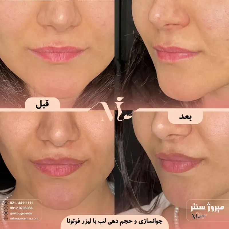 مرکز پزشکی و زیبایی میروژ سنتر