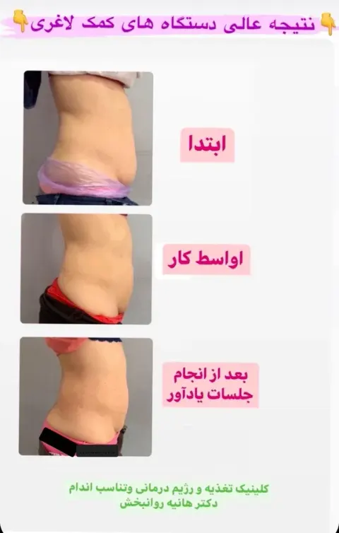 کلینیک تغذیه و رژیم درمانی و تناسب اندام (دکتر هانیه روانبخش)